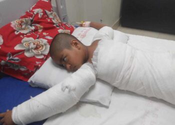 সোনারগাঁয়ে শিশুকে পুড়িয়ে হত্যার চেষ্টা