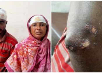 সোনারগাঁয়ের বারদীতে সন্ত্রাসী বাপ্পি বাহিনীর হামলায় রক্তাক্ত জখম-৩