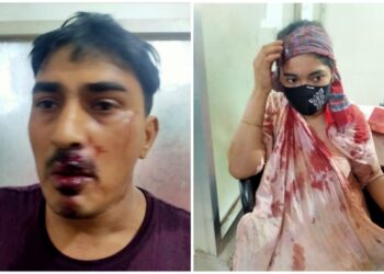 সোনারগাঁয়ের নোয়াগাঁওয়ে সন্ত্রাসী অহিদ বাহিনী হামলায় রক্তাক্ত জখম -৩