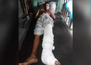 সোনারগাঁয়ে মাদক ব্যবসায় বাঁধা দেওয়ায় রিক্সা চালককে কুপিয়ে জখম 