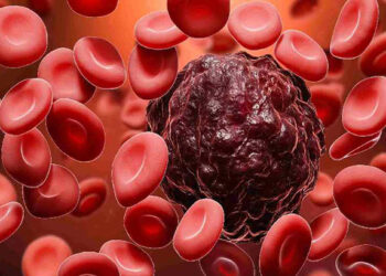 মরণ ঘাতক ব্লাড ক্যানসারের এই লক্ষণগুলো এড়িয়ে যাচ্ছেন ?