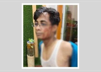 জাগো নিউজের সাংবাদিক মোবাশ্বির শ্রাবণ গুলিবিদ্ধ