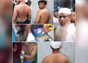 নগরীর দ্বিগু বাবুর বাজার নিয়ন্ত্রনে দুই পক্ষের মধ্যে সংঘর্ষ, আহত ৩