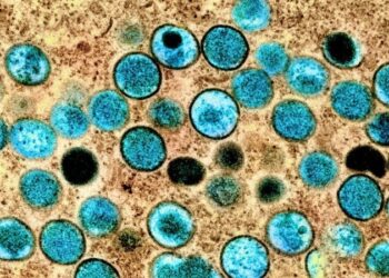 করোনার মতো ছড়াবে না এমপক্সের সংক্রমণ , নিয়ন্ত্রণ সম্ভব – বিশ্ব স্বাস্থ্য সংস্থা