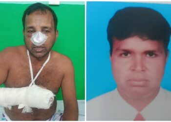 বক্তাবলীতে সন্ত্রাসী কাশেম বাহিনীর হামলায় ব্যবসায়ী মোঃ হাসান রক্তাক্ত জখম