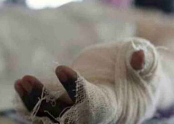 রূপগঞ্জে স্টিল মিলে বিস্ফোরণে ৩ শ্রমিক দগ্ধ