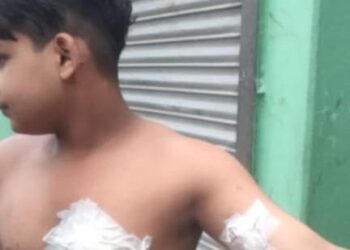 বন্দরে প্রতিপক্ষের হামলায় একই পরিবারের ৩ জন আহত