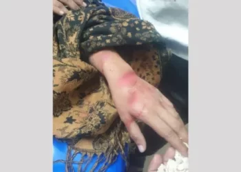 যৌতুকের দাবিতে সাংবাদিক কন্যাকে কুপিয়ে জখম, শাশুড়ি আটক