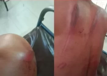 গিয়াসের ২ ছেলে কতৃক মান্নান সমর্থকদের উপর হামলা
