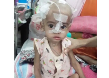 রূপগঞ্জে হামে আক্রান্ত দুই শিশুর মৃত্যু, এলাকায় আতঙ্ক