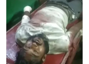ফতুল্লায় সোর্স মামুনকে কুপিয়ে জখম!