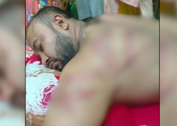 রূপগঞ্জে সাংবাদিকের ওপর হামলায় নিন্দা