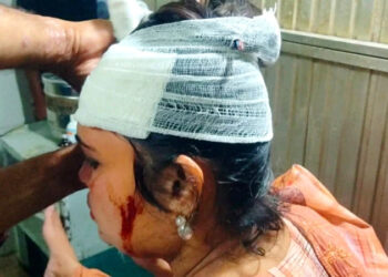 ফতুল্লায় ছিনতাইকারীর ছুরিকাঘাতে বাউল শিল্পী রক্তাক্ত