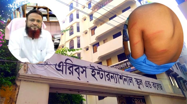 এরিবস স্কুলে শাসনের নামে বেত্রাঘাত? প্রধান শিক্ষকের বিরুদ্ধে থানায় অভিযোগ