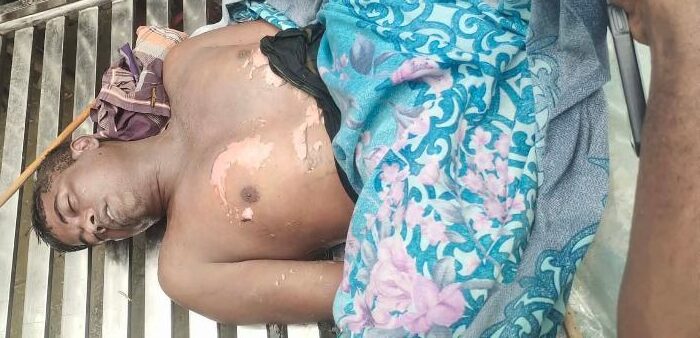 জামালপুরে ইসলামপুরে বজ্রপাতে পল্লী চিকিৎসকের মৃত্যু