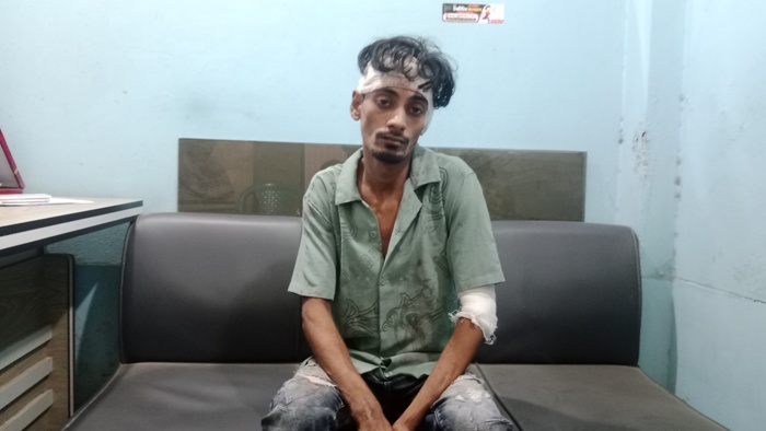 ফতুল্লায় টিসিবি ডিলার বিপ্লবকে কুপিয়ে টাকা লুটে নিল নামধারী বিএনপি নেতা টিপু গং!